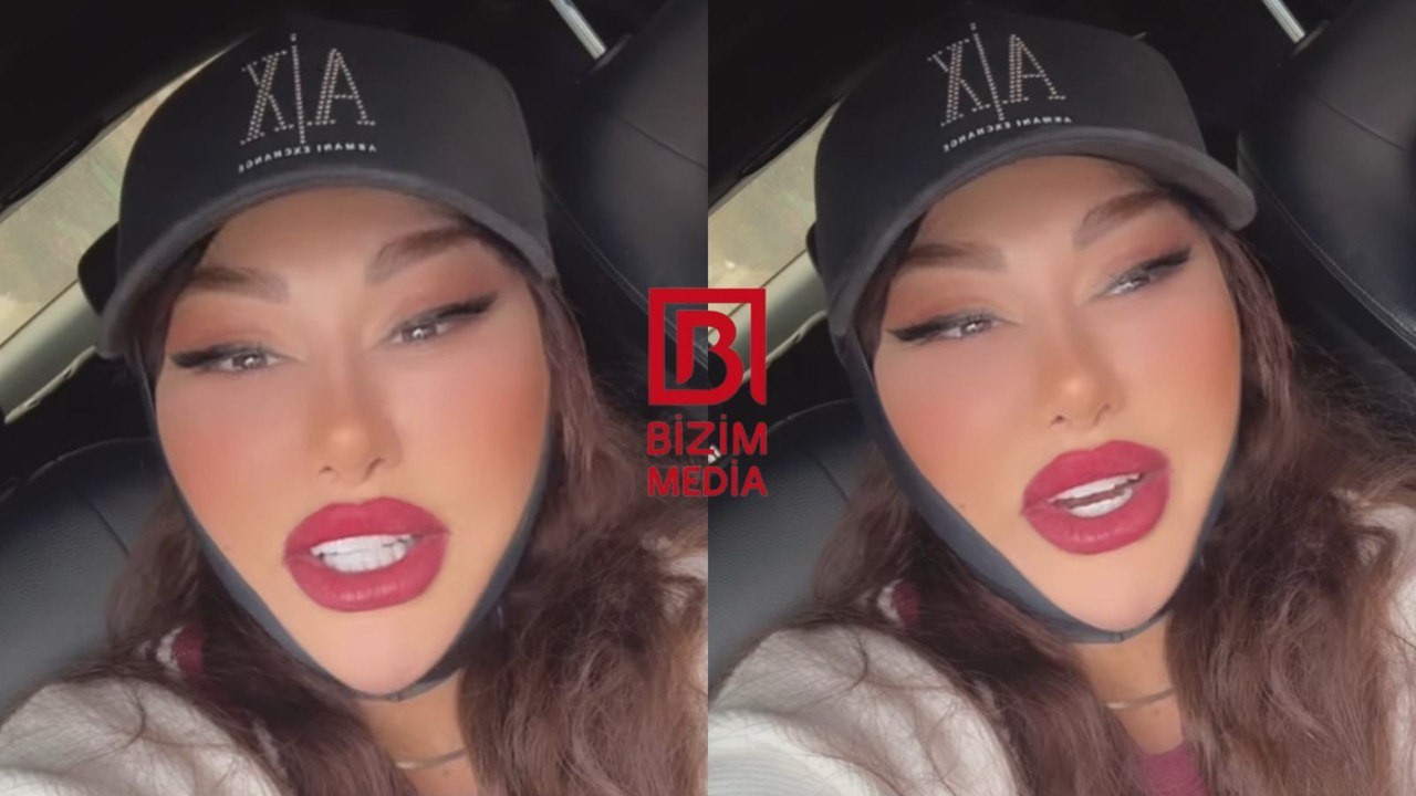 Fatimə estetik əməliyyatdan sonra tanınmaz halda -