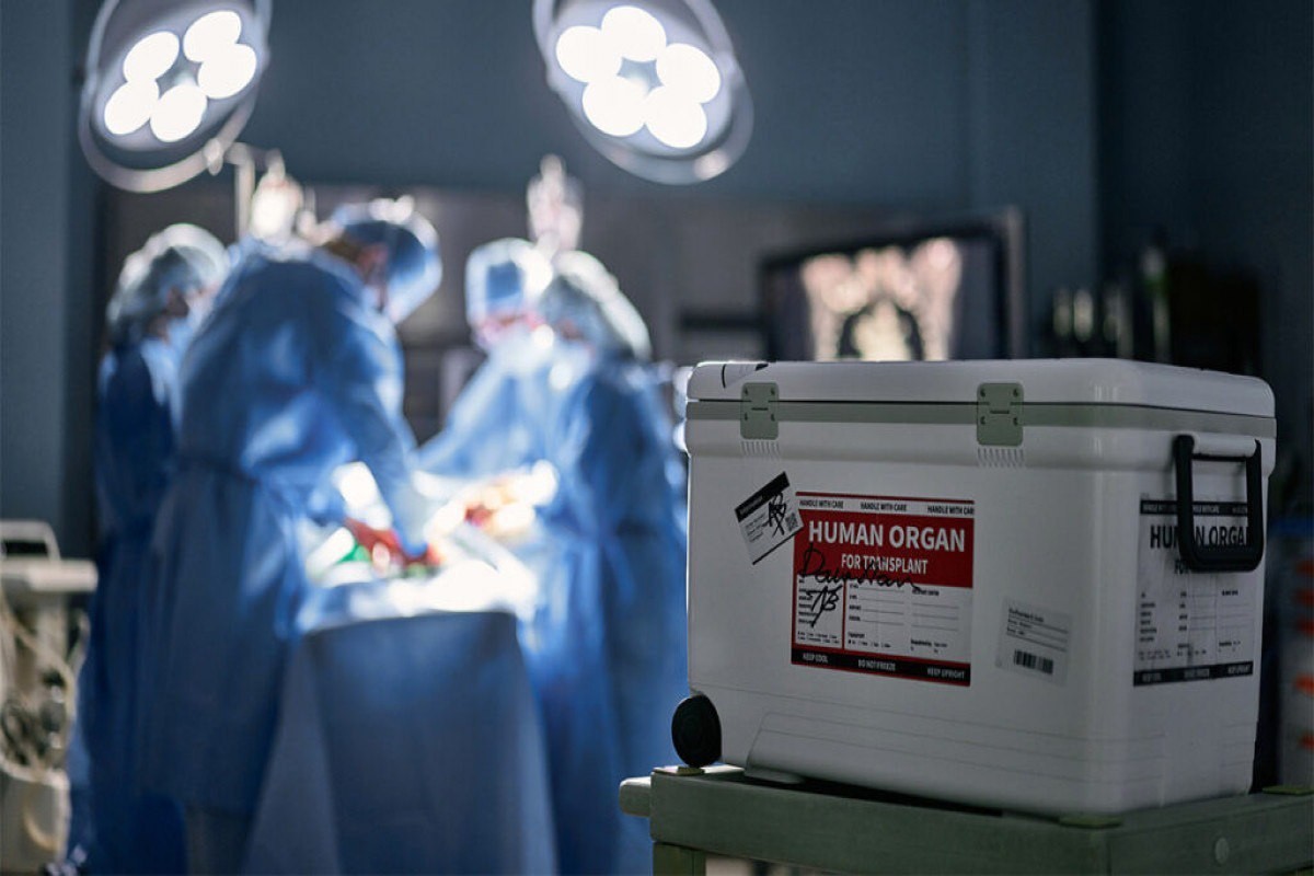Azərbaycanda daha bir meyit donordan böyrək köçürüldü –