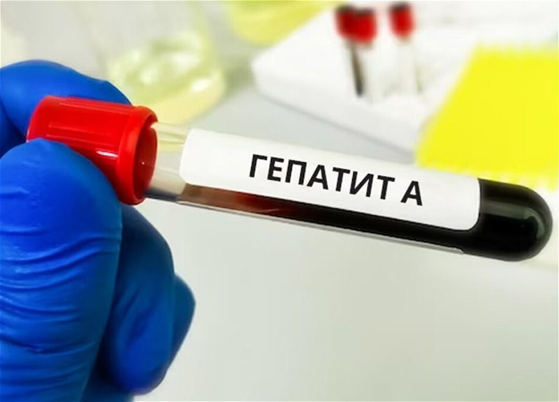 В Чехии жертвой вспышки гепатита А стали более 30 человек