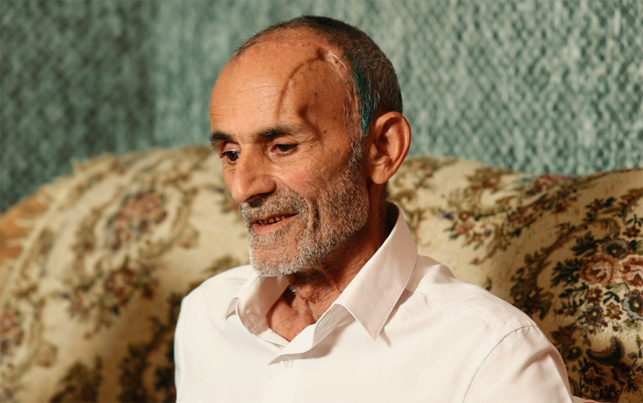 İcbari tibbi sığorta ilə beyin əməliyyatı olundu - Video