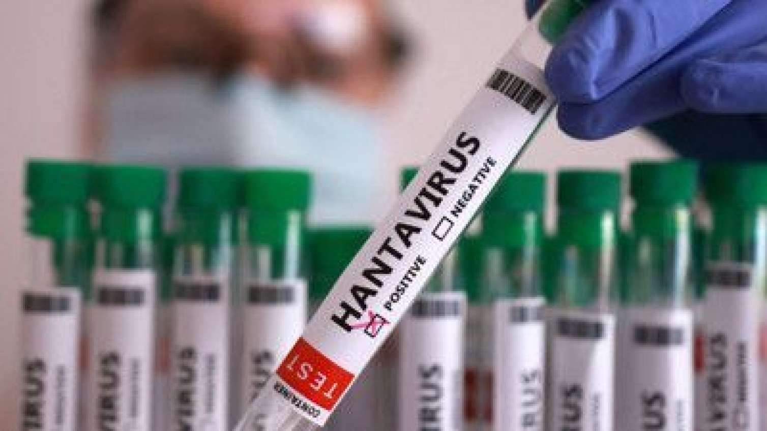 Hantavirus Azərbaycana gəlib?  - RƏSMİ
