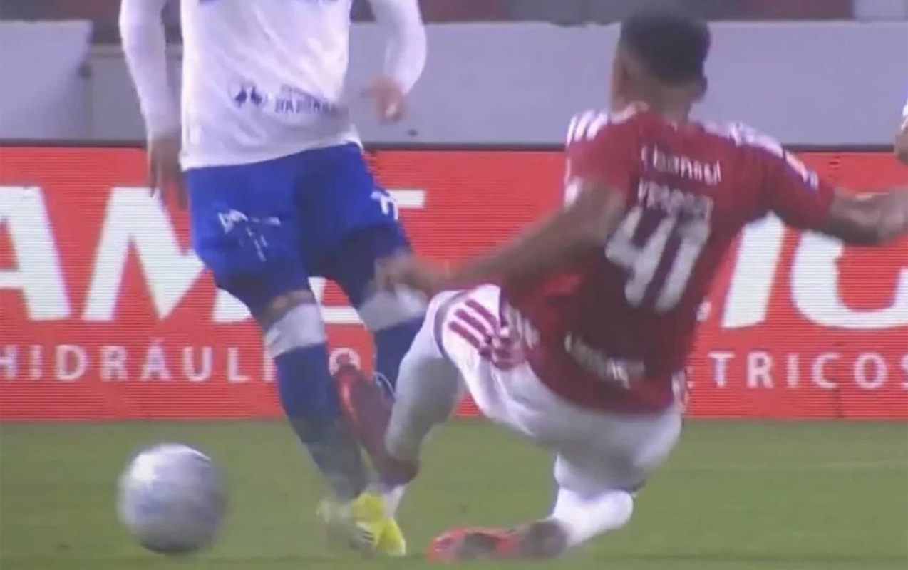Zədələdiyi rəqibi sağalana qədər meydana çıxa bilməyəcək - Futbolda ilk - Fotolar