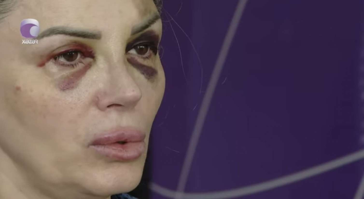 Bakıda mağazada döyülən qadın danışdı: “Demişdi ki, səni doğrayacağam” - VİDEO