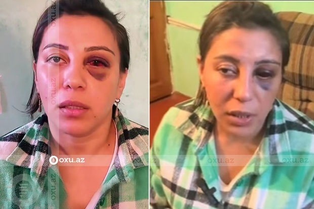 Bakıda DƏHŞƏT: Ər arvadını döyərək bu hala saldı - ŞOK VİDEO