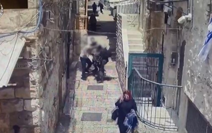 Türkiyəli turist Qüdsdə İsrail polisini bıçaqladı -