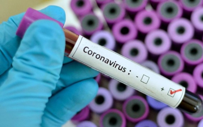Как там с коронавирусом в Азербайджане?