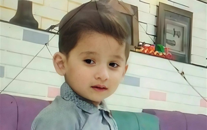 В Баку 5летний мальчик умер после удаления зуба