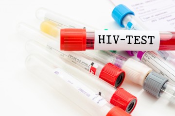 В Азербайджане за полгода выявлено 736 ВИЧ-инфицированных