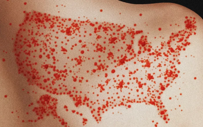 Study warns measles could become endemic in US as vaccination rates continuously fall