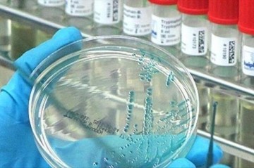 Scientists discover new coronavirus