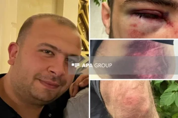 Azerbaijani citizen describes beating by Russian law enforcement officers in Yekaterinburg