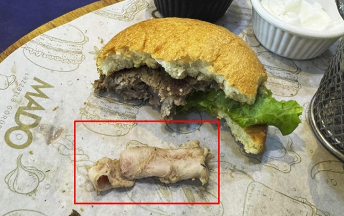 "Mado"dan alınan burqerin içərisindən görün nə çıxdı - Araşdırma başladı