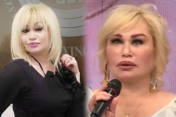 “Plastik əməliyyatda sinirimə toxunulub...”
