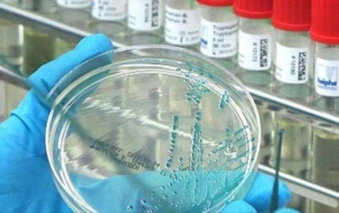 ABŞ-da "beyin yeyən" infeksiya aşkarlandı