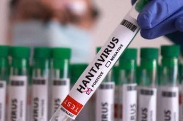 Hantavirus Azərbaycana gəlib?  - RƏSMİ