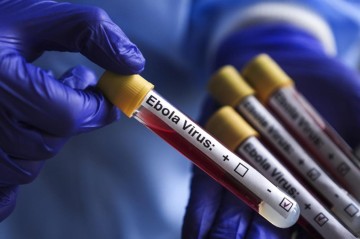 ABŞ-dən Ebola ilə bağlı - Xəbərdarlıq