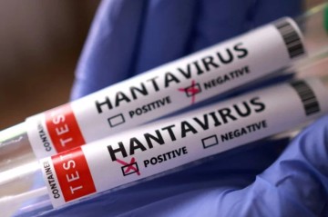 Venesuelada hantavirus həyəcanı: