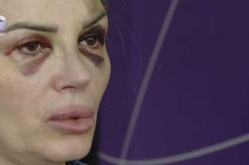 Bakıda mağazada döyülən qadın danışdı: “Demişdi ki, səni doğrayacağam” - VİDEO