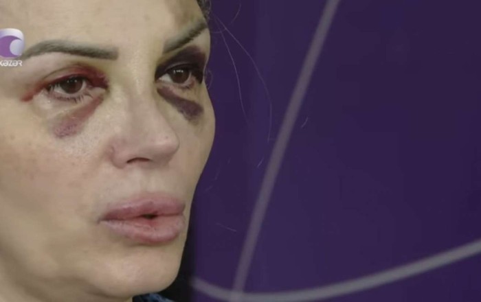 Bakıda mağazada döyülən qadın danışdı: “Demişdi ki, səni doğrayacağam” - VİDEO