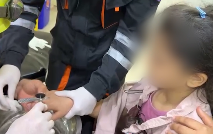 Barmağında üzük sıxılı qaldı - Belə xilas olundu+Video