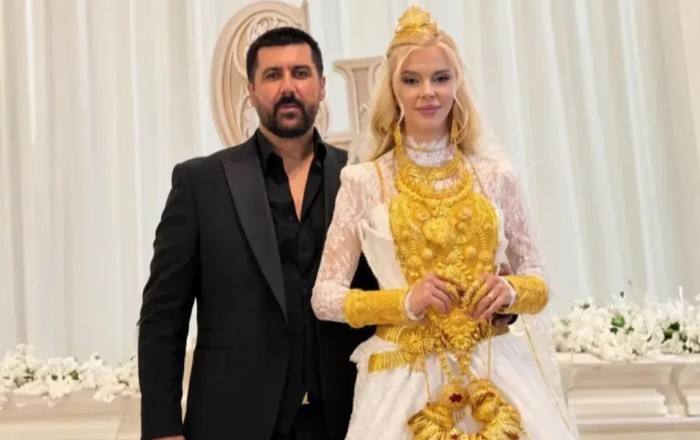 Qalmaqallı toyla bağlı ŞOK DETALLAR üzə çıxdı: Qızıllar saxta imiş... – FOTO