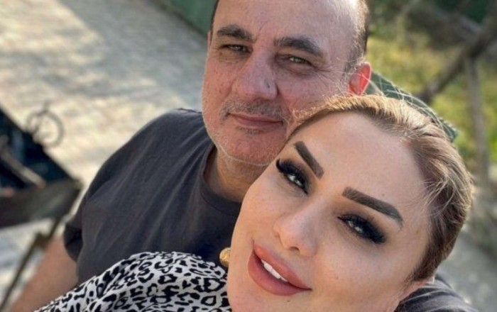 Plastik cərrahı qətlə yetirən əri mirasdan məhrum edildi