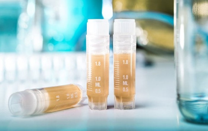 Woman dies of plague in Siberia, dozens under quarantine